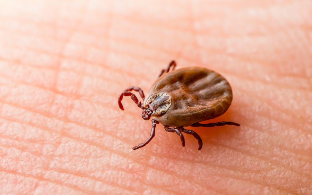 Understanding Ticks and Rocky Mountain Spotted Fever (RMSF)