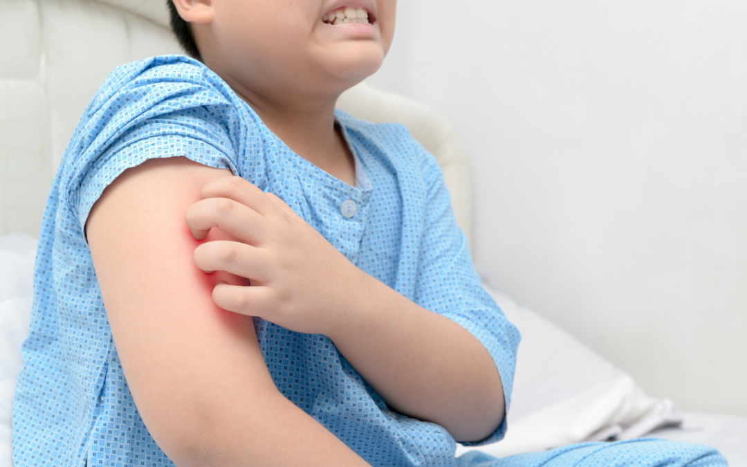 Why Does My Skin Feel So Dry During Fall?