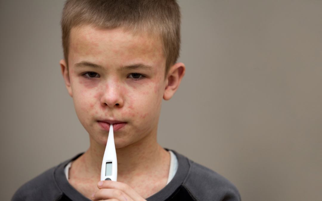 Is Measles Making a Comeback?